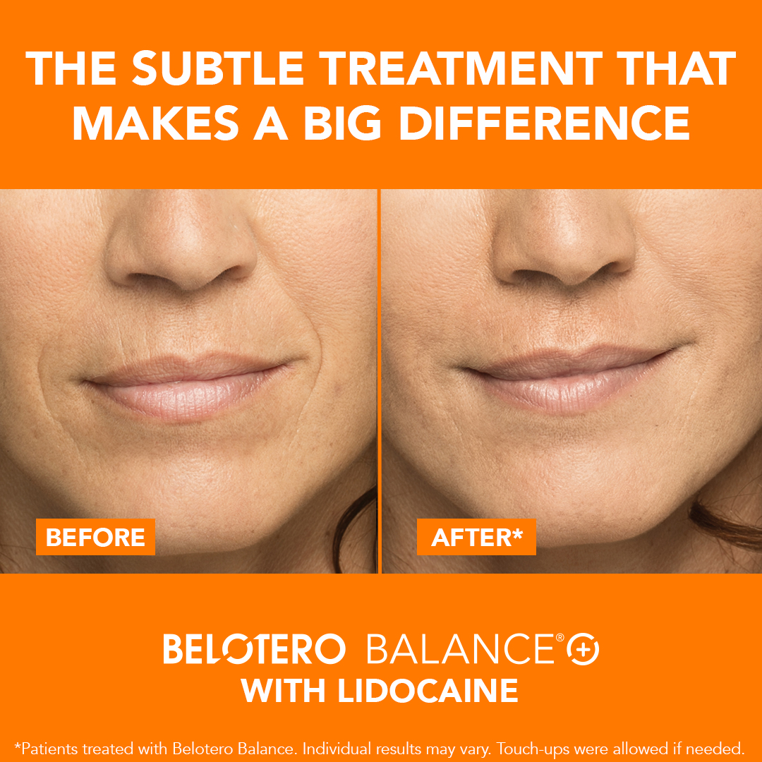 A woman 's face with two different treatments on it.